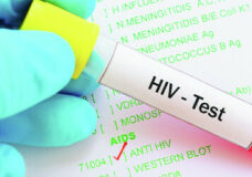 S2 WAD HIV Test i Stock 862781692