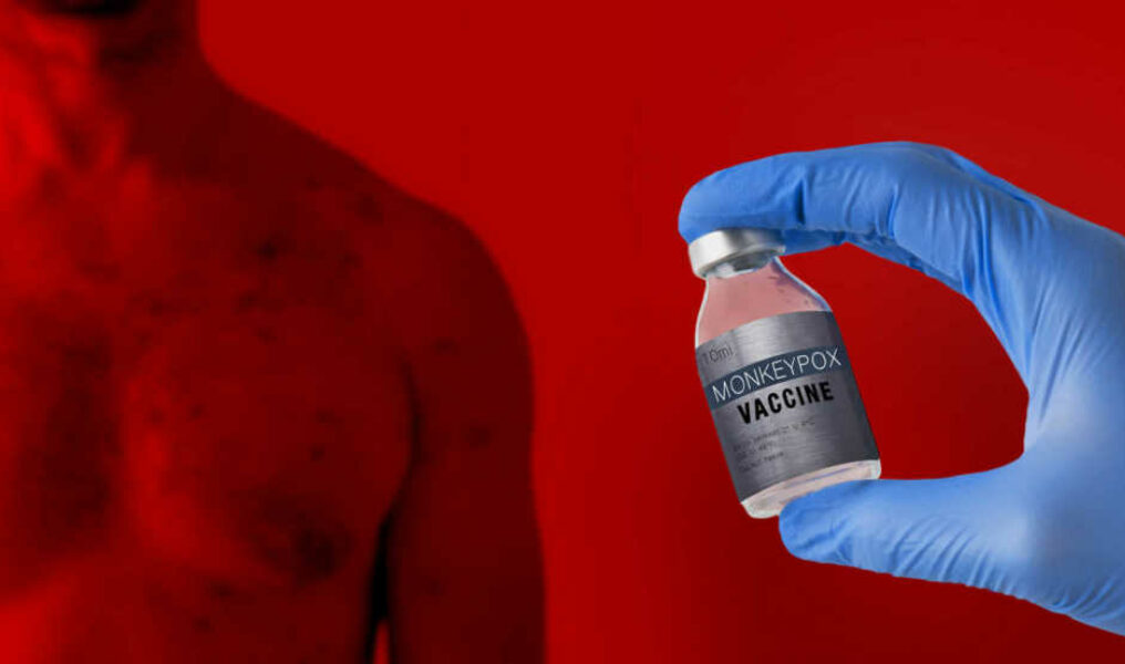 Doctors Hand Holding Monkeypox Vaccine With Male Chest Affected
